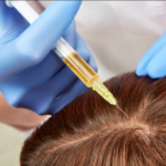 hair_restoration_brooklyn_long_island