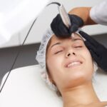 Microneedling_brooklyn